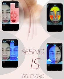 เครื่องทดสอบสภาพผิวด้วยระบบดิจิตอลพร้อมเครื่องมือในการถ่ายภาพ / วิเคราะห์ / แสดงผล 3 In 1