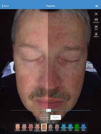 VISIA ใบหน้าสแกนเนอร์การวิเคราะห์กระจกวิเศษวิเคราะห์ผิวทดสอบผิวมืออาชีพสำหรับหมอคลินิก Usd ฟังก์ชั่น 3D CE FCC