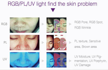 เครื่องวิเคราะห์ความชุ่มชื้นผิวแบบมืออาชีพ 3D Wrinkle ด้วย 18 ล้านพิกเซลพิกเซล