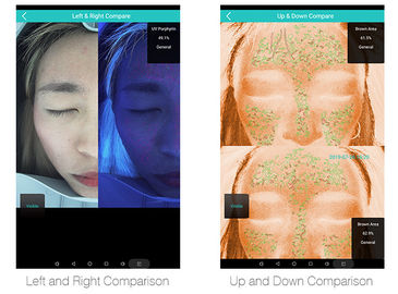 Intelligent Skin Hydration Analyzer Magic Mirror สำหรับโรงเรียนฝึกอบรม