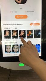 เกาหลีระบบการวิเคราะห์ใบหน้าดิจิตอลการจัดเก็บ 64GB สำหรับคลินิกแพทย์