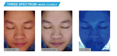กระจกวิเศษวิเคราะห์ใบหน้าอัจฉริยะวิเคราะห์ VS0010 เป็นไปตามมาตรฐาน RoHS