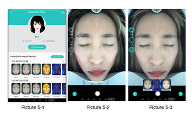 ระบบวิเคราะห์ Wrinkel Face Camera 3d Face Scanner สแกนเนอร์อัตโนมัติ