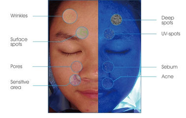 แพทย์เครื่องสำอางพกพาวิเคราะห์ผิว Magic Mirror กล้องความละเอียดสูง