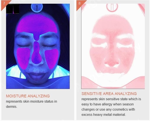 Skincare Wrinkle Pigmentation Acne Skin Analyzer Machine 3D Smart Quizzes