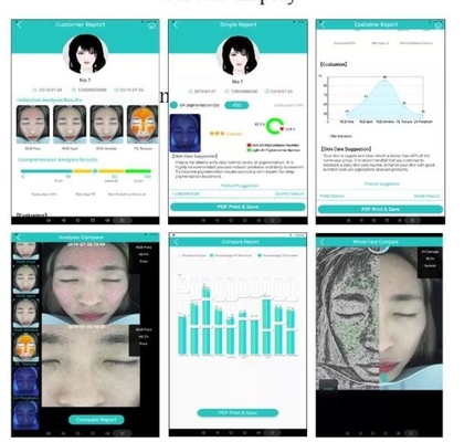 Professional Skin Hydration Analyzer กล้องหน้า 10.4 นิ้วหน้าจอ 20MP