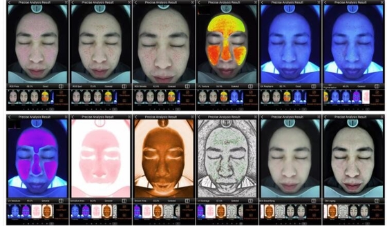 เครื่องวิเคราะห์ผิวอัจฉริยะ RGB UV PL