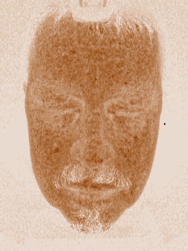 High Definition 5d Skin Scanner วิเคราะห์ระบบวิเคราะห์ผิวที่บอบบางสำหรับ Salone Spa